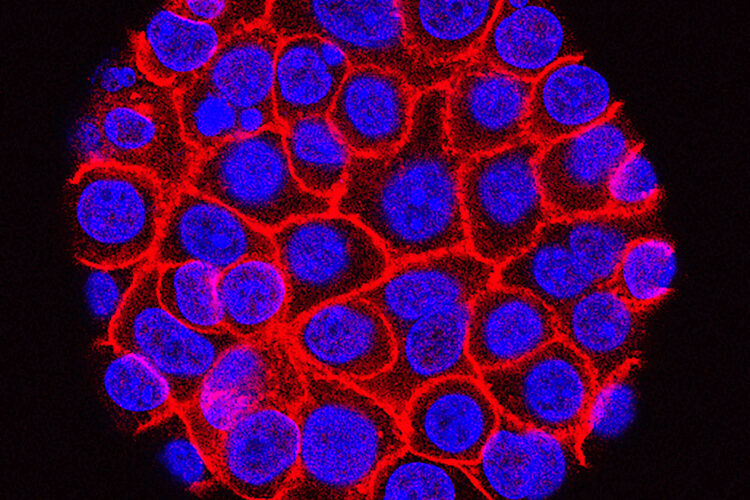 Study shows pill’s effect on pancreatic cancer patients
